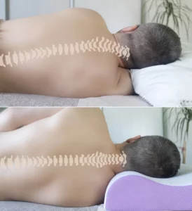 בעיות עמוד שדרה צווארי